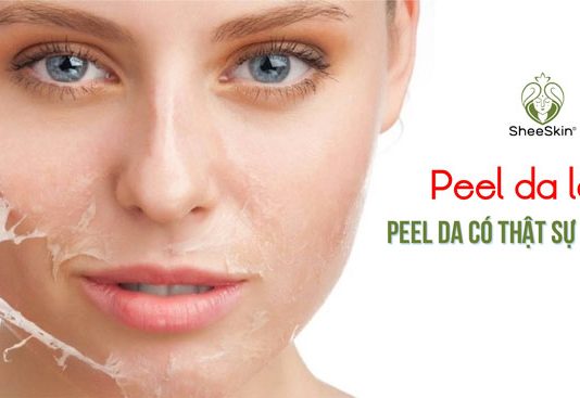 Peel da là gì? Peel da có thật sự tốt không? Peel da là gì, peel da có tốt không, sheeskin